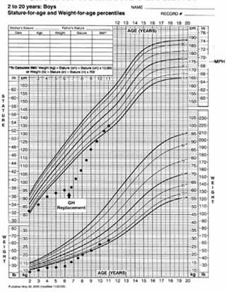 Idiopathic Short Stature Growth Chart